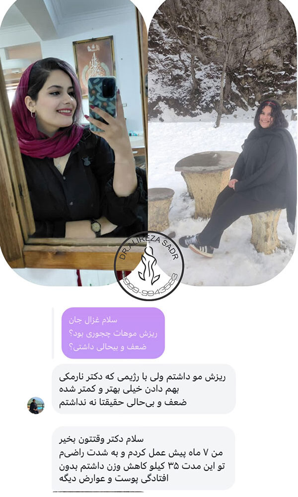 افرادی که عمل چاقی کرده اند قبل و بعد