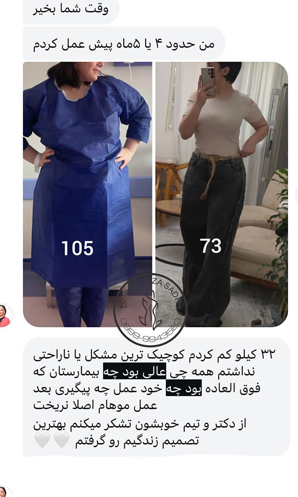 افرادی که عمل چاقی کرده اند قبل و بعد